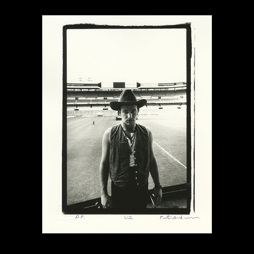 U2